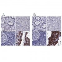 Anti-AAK1 antibody produced in rabbit