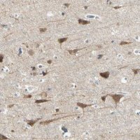 Anti-AATK antibody produced in rabbit