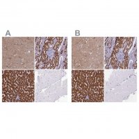 Anti-ABAT antibody produced in rabbit