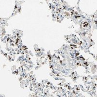 Anti-ABCA3 antibody produced in rabbit