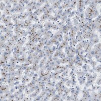 Anti-ABCB11 antibody produced in rabbit
