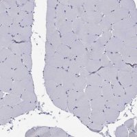 Anti-ABCB4 antibody produced in rabbit