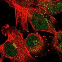 Anti-ABCB6 antibody produced in rabbit