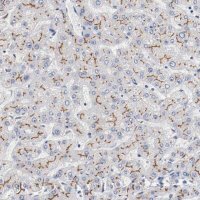 Anti-ABCC2 antibody produced in rabbit