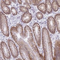 Anti-ABCC3 antibody produced in rabbit