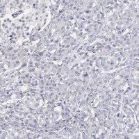 Anti-ABCC4 antibody produced in rabbit