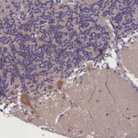 Anti-ABCC8 antibody produced in rabbit