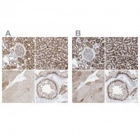 Anti-ABCD3 antibody produced in rabbit