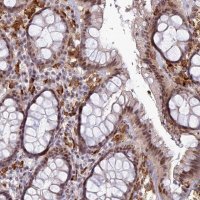 Anti-ABHD17A antibody produced in rabbit HPA043270-100UL
