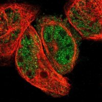 Anti-ABHD4 antibody produced in rabbit 