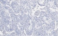 Anti-Ac--Tubulin (Lys40) Antibody, clone 1L10, ZooMAb� Rabbit Monoclonal 
