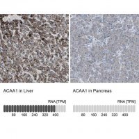 Anti-ACAA1 antibody produced in rabbit