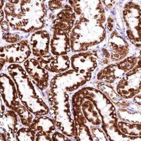Anti-ACAA2 antibody produced in rabbit HPA042303-100UL