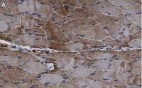 Anti-ACAD10 Antibody, clone 3J20 ZooMAb� Rabbit Monoclonal 