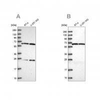 Anti-ACAD9 antibody produced in rabbit 