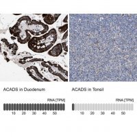 Anti-ACADS antibody produced in rabbit 