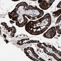 Anti-ACADS antibody produced in rabbit 