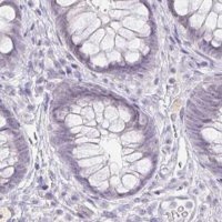 Anti-ACAN antibody produced in rabbit