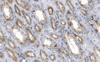 Anti-ACC1 Antibody, clone 1J8 ZooMAb� Rabbit Monoclonal 