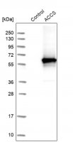 Anti-ACCS antibody produced in rabbit 