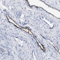 Anti-ACKR1 antibody produced in rabbit