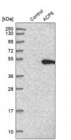 Anti-ACP6 antibody produced in rabbit 