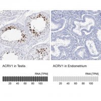 Anti-ACRV1 antibody produced in rabbit 