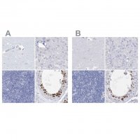 Anti-ACRV1 antibody produced in rabbit