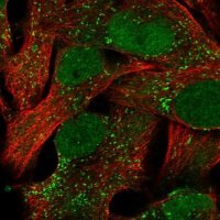 Anti-ACSBG1 antibody produced in rabbit