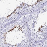 Anti-ACSBG2 antibody produced in rabbit 
