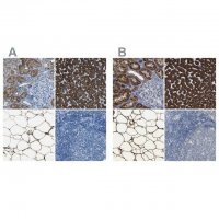 Anti-ACSL1 antibody produced in rabbit 