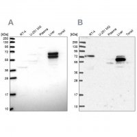 Anti-ACSS3 antibody produced in rabbit 