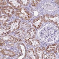 Anti-ACSS3 antibody produced in rabbit 