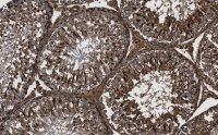 Anti-Actin Antibody, clone C4 ZooMAb� Mouse Monoclonal 