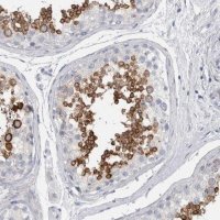 Anti-ADAM2 antibody produced in rabbit 