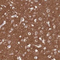 Anti-ADD2 antibody produced in rabbit