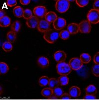 Anti-Adenovirus Hexon Antibody, clone 7/48.7c ZooMAb� Mouse Monoclonal 