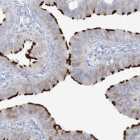 Anti-ADGB antibody produced in rabbit 