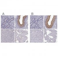 Anti-ADGRG2 antibody produced in rabbit