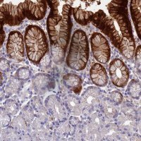 Anti-ADH7 antibody produced in rabbit 