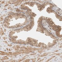Anti-ADSS antibody produced in rabbit