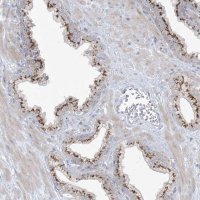 Anti-AFTPH antibody produced in rabbit