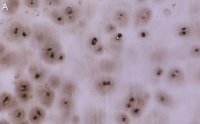 Anti-Aggrecan Antibody, clone 4B10 ZooMAb� Rabbit Monoclonal 