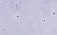 Anti-Aggrecan Antibody, clone 4B10 ZooMAb� Rabbit Monoclonal 