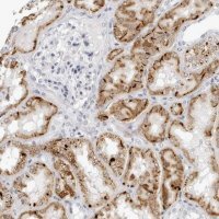 Anti-AGMAT antibody produced in rabbit