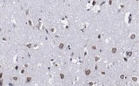 Anti-Ago2 Antibody, clone 2H10 ZooMAb� Rabbit Monoclonal 