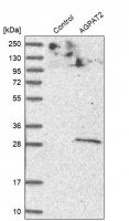 Anti-AGPAT2 antibody produced in rabbit 