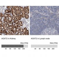 Anti-AGXT2 antibody produced in rabbit 