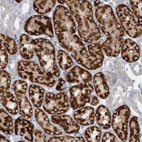 Anti-AGXT2 antibody produced in rabbit