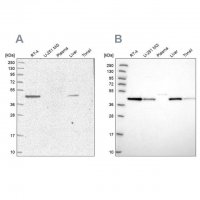 Anti-AHCY antibody produced in rabbit 